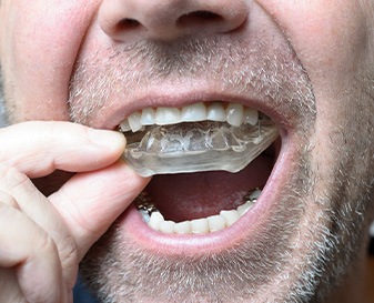 A man putting on a mouthguard