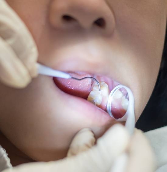 Childrens dentist giving a child a dental exam