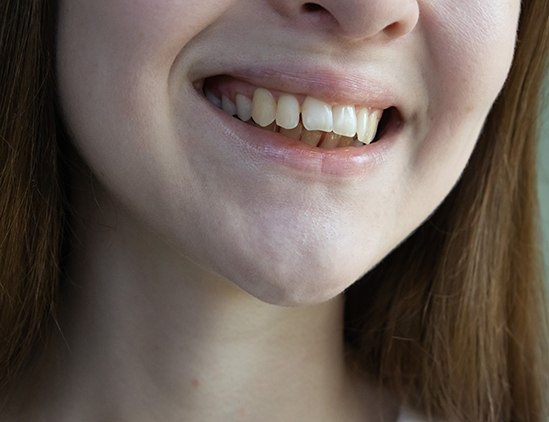Nose-to-neck view of woman with malocclusion smiling