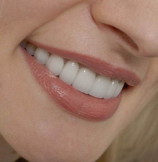 Close up of smiling blonde woman with straight white teeth