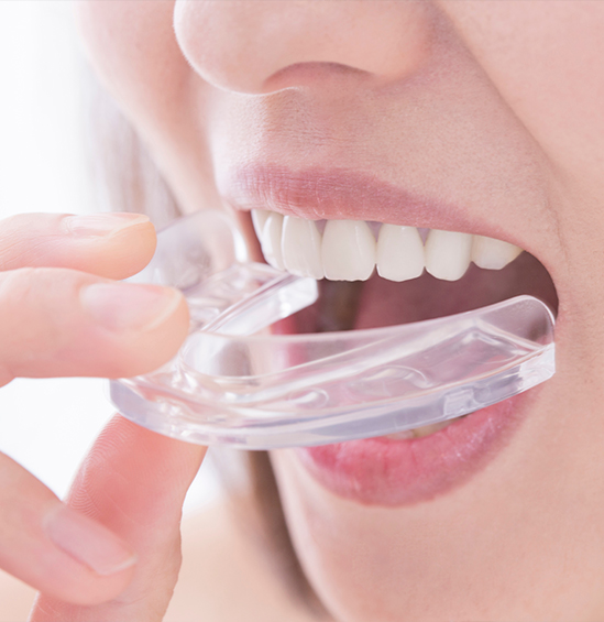 Close up of person placing clear nightguard over their teeth