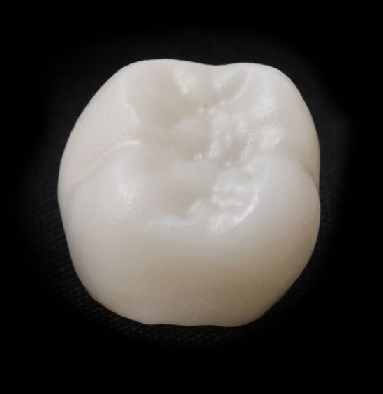 Close up of white dental crown against black background