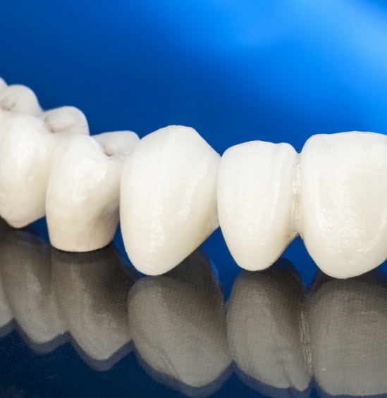 Dental bridge against dark blue background