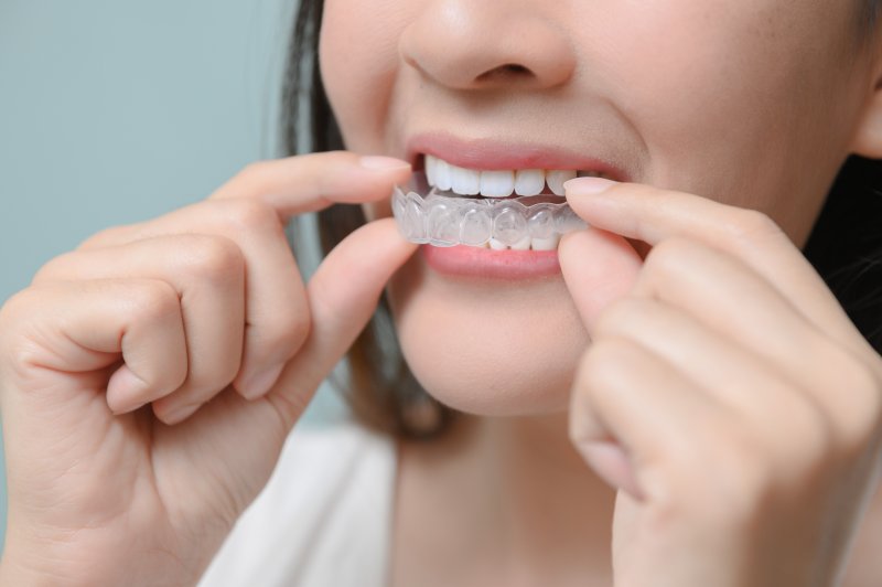 A young woman removing her clear aligners